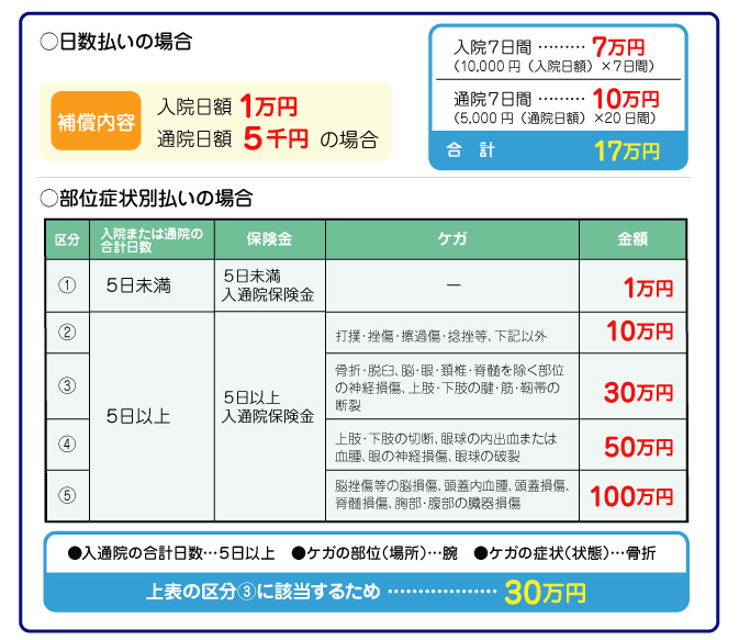 日数払いと部位症状別払い